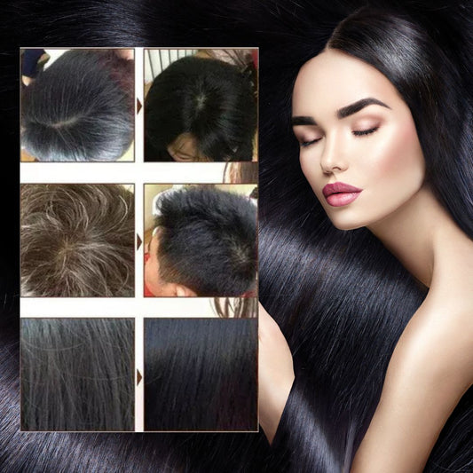 Natural Hair Dye Shampoo (😍Buy 1 Get 3 FREE Today Only Offer)