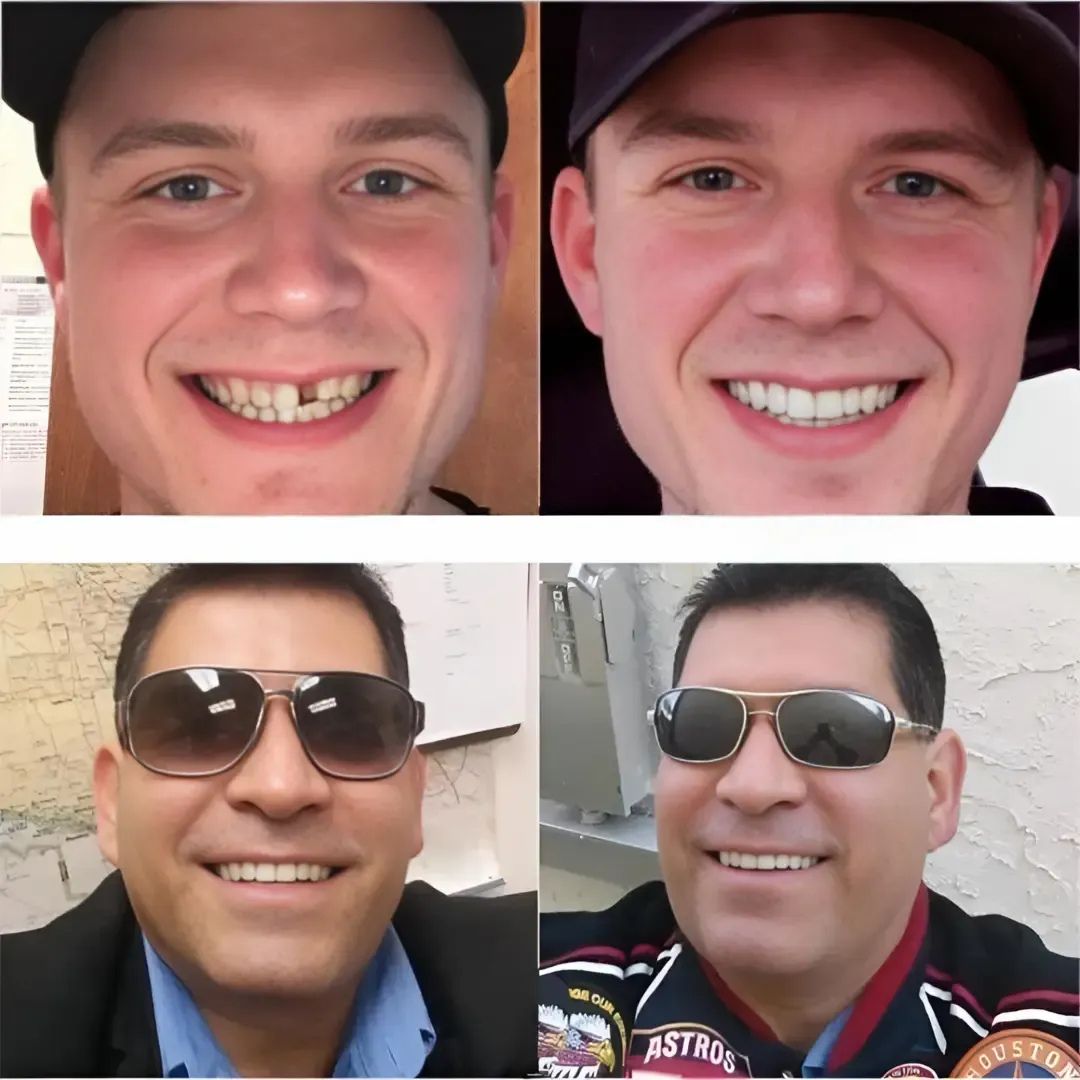 Magic Smile Teeth Braces (😍Buy 1 Get 2 FREE Today Only)
