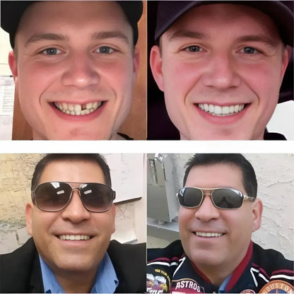 Magic Smile Teeth Braces (😍Buy 1 Get 2 FREE Today Only)