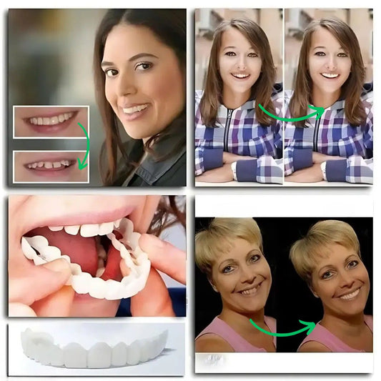 Magic Smile Teeth Braces (😍Buy 1 Get 2 FREE Today Only)