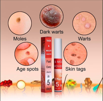 Tags & Moles Remover Cream (😍Buy 1 Get 1 FREE Today Only Offer)