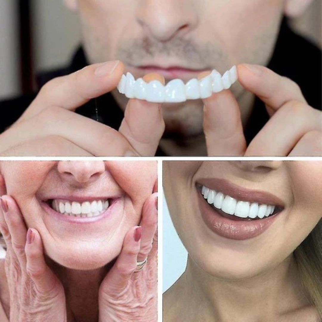 Magic Smile Teeth Braces (😍Buy 1 Get 2 FREE Today Only)