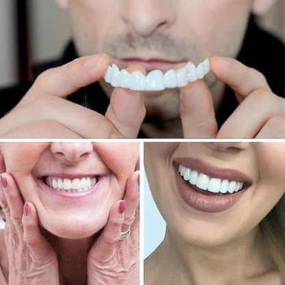 Magic Smile Teeth Braces (😍Buy 1 Get 2 FREE Today Only)